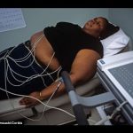 5 Medical conditions relating to obesity